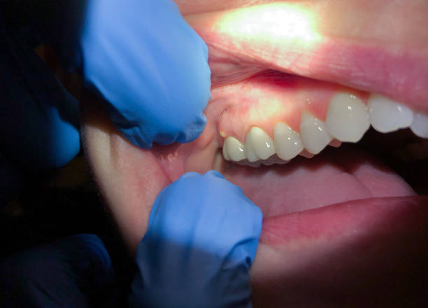 Best Cracked Tooth Emergency Dentist  in Seaford, DE