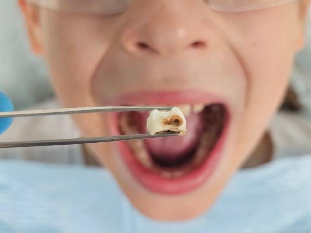 Best Knocked-Out Tooth Emergency  in Seaford, DE