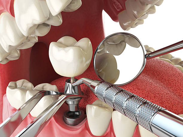 Best Urgent Tooth Repair  in Seaford, DE
